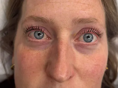 Après : rehaussement de cils